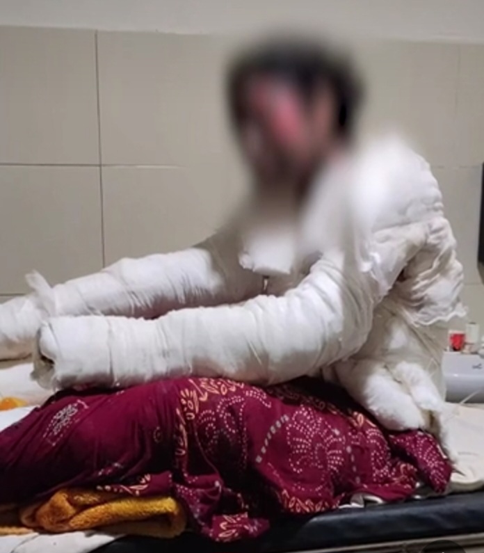 पंजाब के मोहाली में शर्मसार करने वाली घटना  नाबालिग को उसी के घर आकर सैनिटाइजर छिड़ककर आग लगाई और कमरे में बंद कर दिया